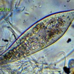 Инфузория-туфелька (Paramecium caudatum)